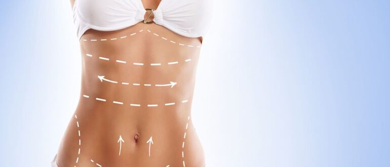 Уменьшение груди после грудного вскармливания для улучшения качества жизни